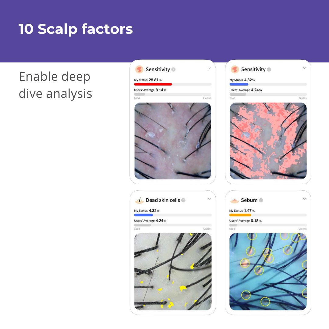Becon AI analysis for Skin and Scalp Scanner + 1 Year Software