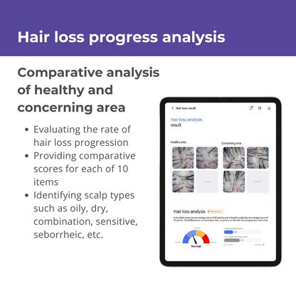 Becon AI analysis for Skin and Scalp Scanner + 1 Year Software