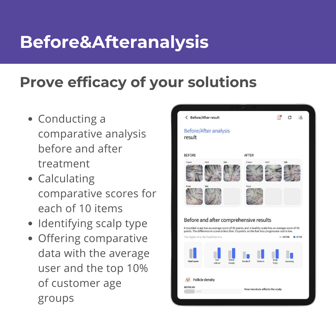 Becon AI analysis for Skin and Scalp Scanner + 1 Year Software