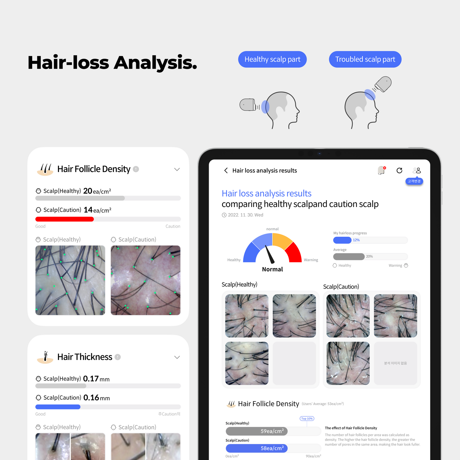 Becon AI analysis for Skin and Scalp Scanner + 1 Year Software