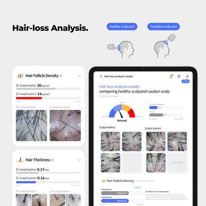 Becon AI analysis for Skin and Scalp Scanner + 1 Year Software